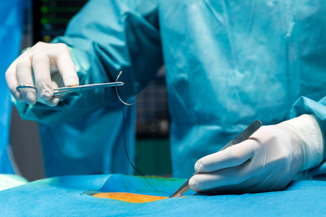 advantages of non absorbable sutures