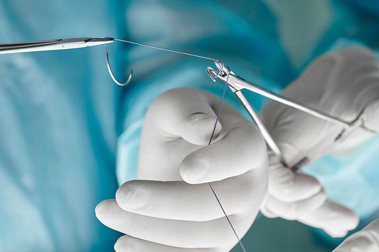 Understanding How to Remove Non Absorbable Sutures at the Right Time