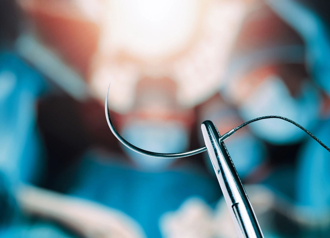 What Veterinary Surgeons Need to Know About Polyamide Nylon Suture Before Choosing It