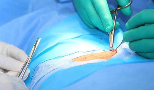 barbed suture material
