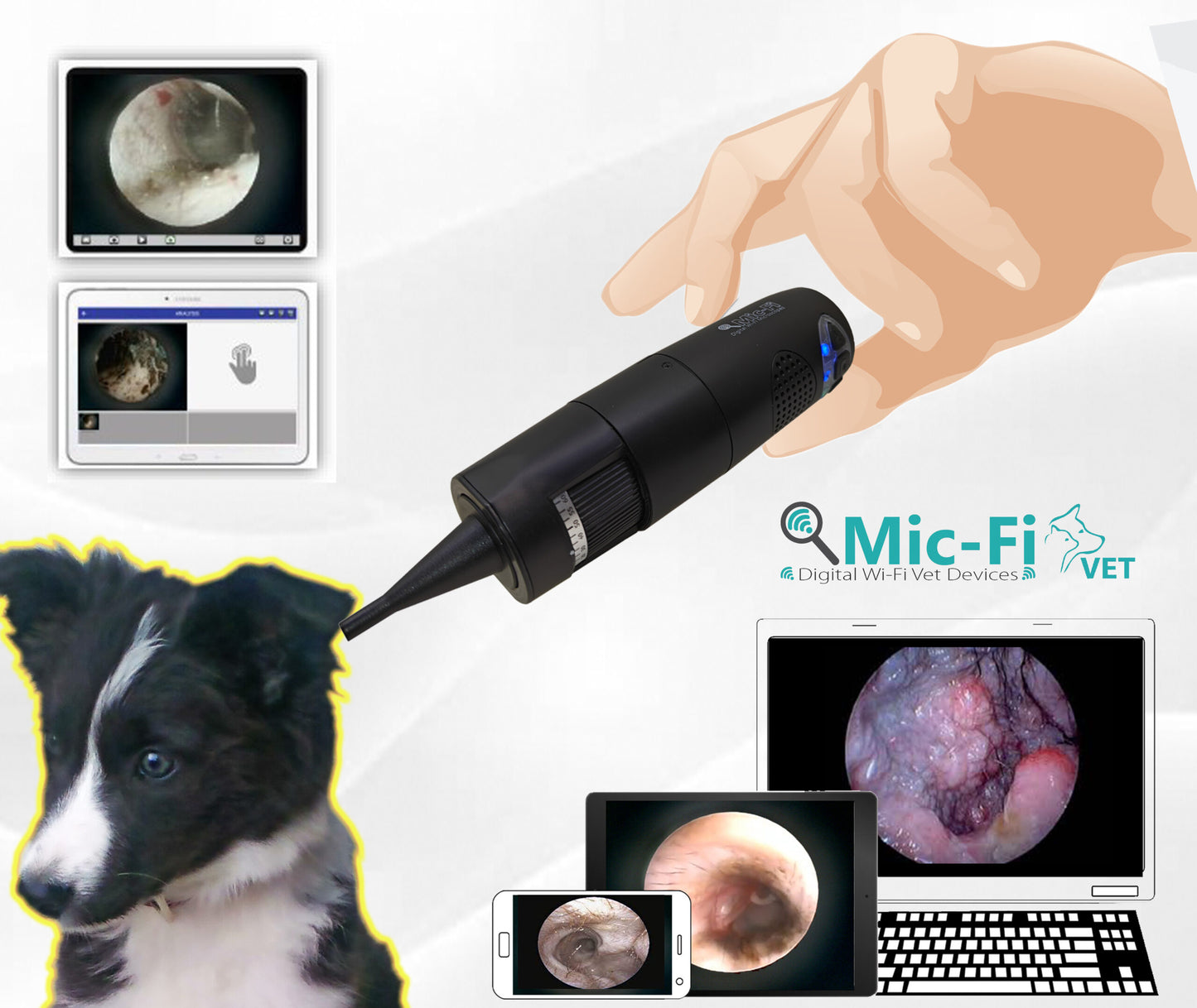 Wi-Fi – USB Digital OTOSCOPE